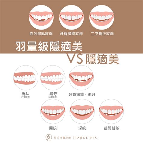 上下排牙齒平行|牙齒矯正咬合問題：如何調整上排牙齒位置？